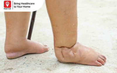 Apa Itu Diabetes Basah dan Bagaimana Cara Menanganinya?