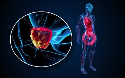 Pantangan Penyakit Prostat: Hindari 11 Hal Ini agar Tak Memburuk