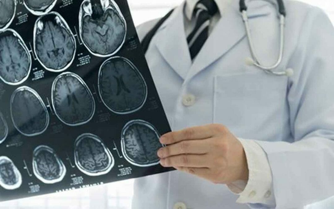 Sifat Pembuluh Darah Sesuai Jenisnya