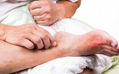 Obat Herbal Rematik Dan Asam Urat Alami Dengan Buah Merah Papua