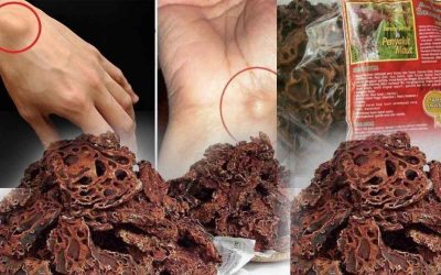 Sarang Semut Papua Untuk Benjolan Abnormal Dan Efek Sampingnya
