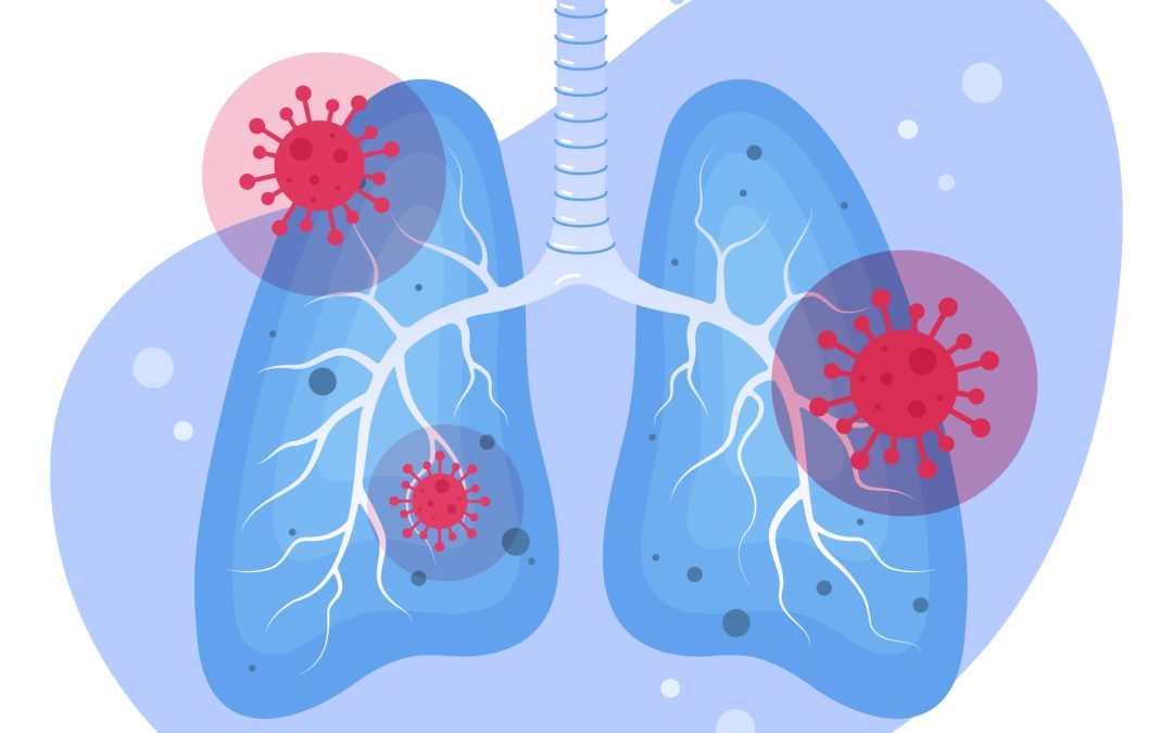 Meningkatnya Kasus Pneumonia: Apa yang Perlu Diketahui?