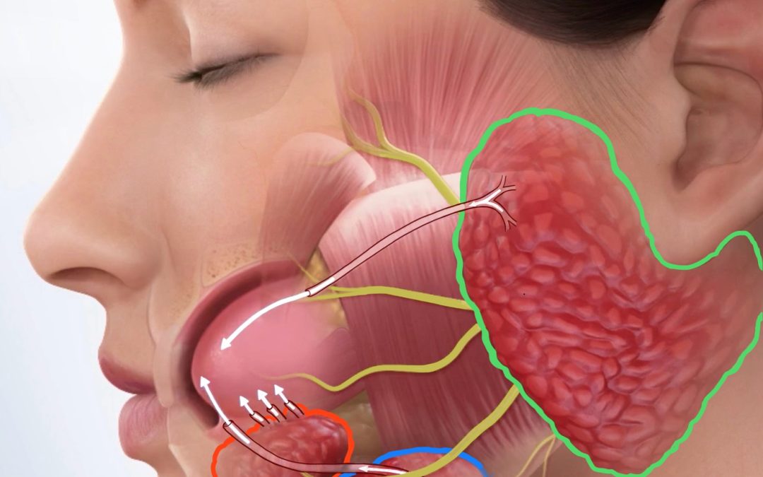 Recovery from Parotid Tumor Surgery: What to Expect