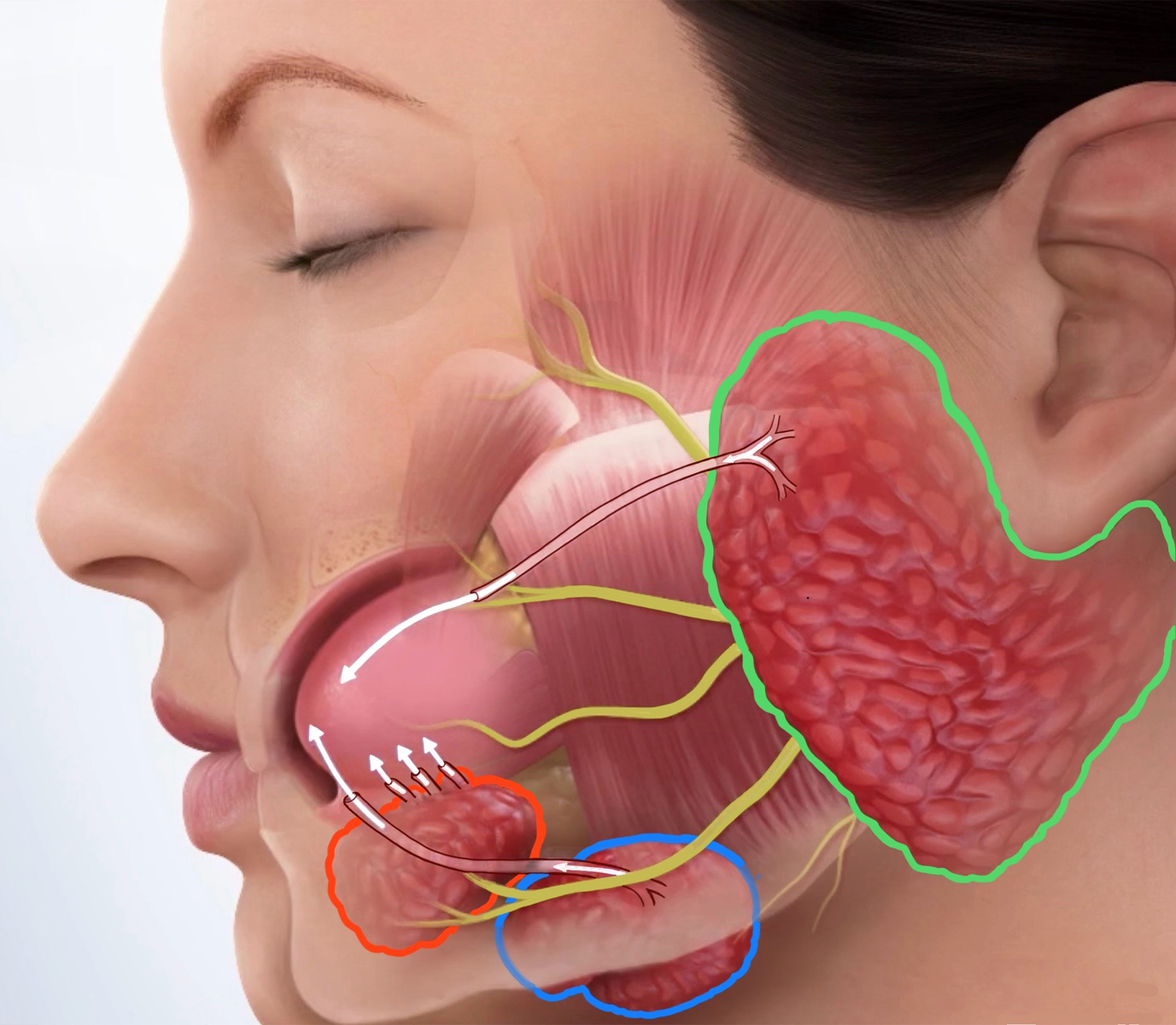 IMG_0452a Recovery from parotid tumor surgery