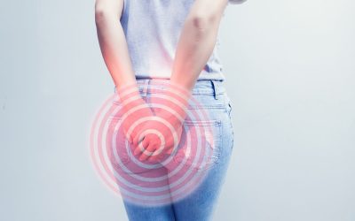 Stage 1 Hemorrhoid: Early Signs and Natural Treatments