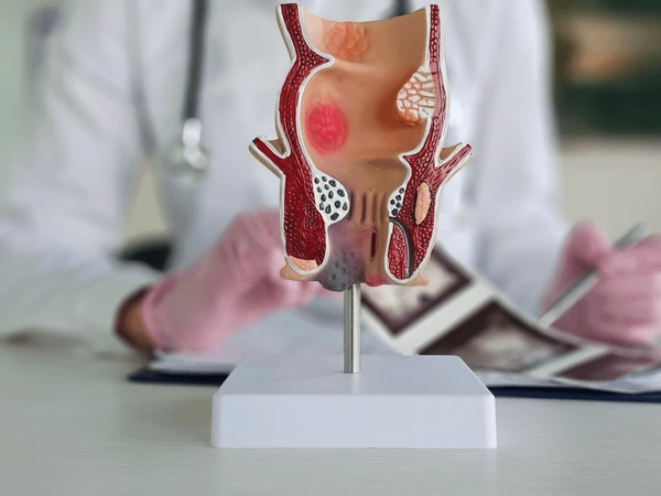 how to get rid of a hemorrhoid while pregnant